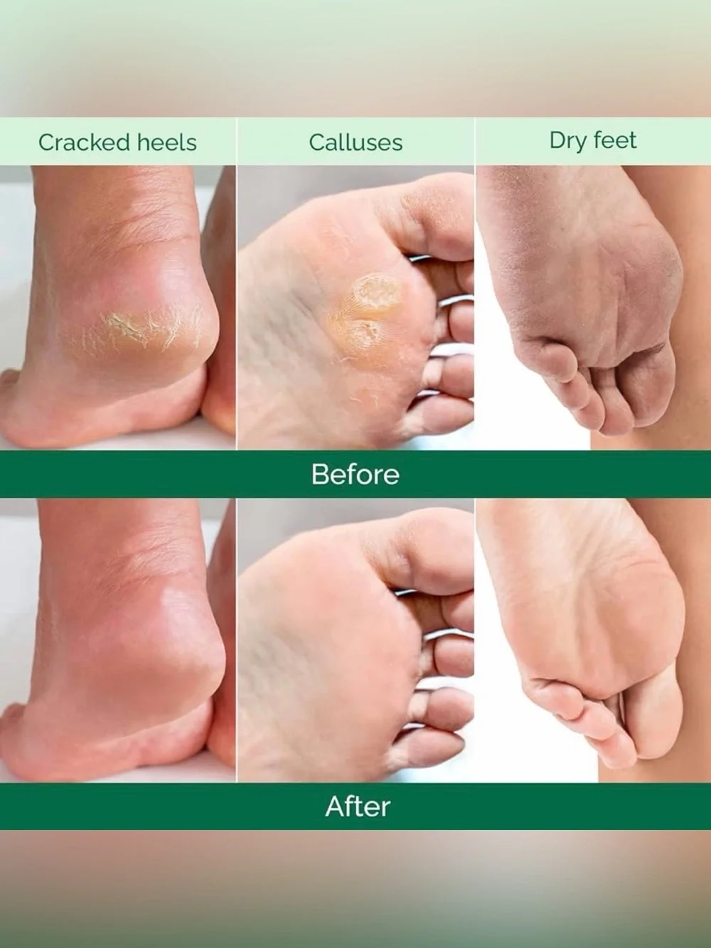 Plantifique Men’s Foot Peel Mask Aloe Vera Exfoliating Treatment 1 Pair